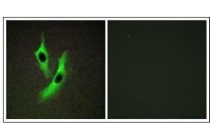 Immunofluorescence analysis of HeLa cells, using STEAP4 Antibody. (STEAP4 antibody)