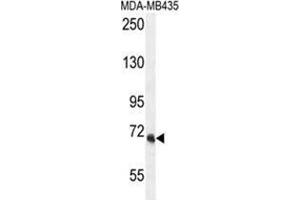 VPS52 Antibody (C-term) western blot analysis in MDA-MB435 cell line lysates (35 µg/lane). (VPS52 antibody  (C-Term))