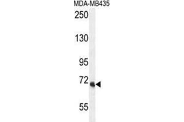 VPS52 抗体  (C-Term)