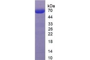 Image no. 1 for Ryanodine Receptor 1 (Skeletal) (RYR1) (AA 97-392) protein (His tag,GST tag) (ABIN6237810)