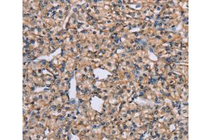 Immunohistochemistry (IHC) image for anti-ADAM Metallopeptidase Domain 29 (ADAM29) antibody (ABIN2427053) (ADAM29 antibody)