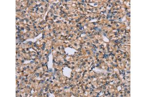 Immunohistochemistry (IHC) image for anti-ADAM Metallopeptidase Domain 29 (ADAM29) antibody (ABIN2427053) (ADAM29 antibody)