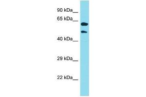 Western Blotting (WB) image for anti-Keratin 39 (KRT39) (N-Term) antibody (ABIN2791629) (Keratin 39 (KRT39) (N-Term) antibody)