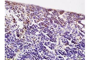 Formalin-fixed and paraffin embedded mouse spleen labeled with Anti ACBD6 Polyclonal Antibody, Unconjugated (ABIN761216) at 1:200 followed by conjugation to the secondary antibody and DAB staining (ACBD6 antibody  (AA 75-170))