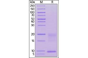 SDS-PAGE (SDS) image for Thymic Stromal Lymphopoietin (TSLP) (AA 29-159) (Active) protein (His tag) (ABIN6253595)