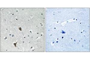 Immunohistochemistry analysis of paraffin-embedded human brain tissue, using OXR1 Antibody.