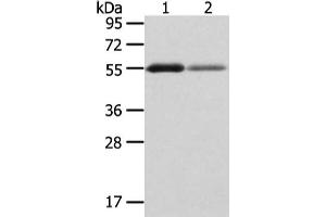 Gel: 8 % SDS-PAGE, Lysate: 40 μg, Lane 1-2: Human thyroid cancer and normal stomach tissue, Primary antibody: ABIN7193074(XKR3 Antibody) at dilution 1/200 dilution, Secondary antibody: Goat anti rabbit IgG at 1/8000 dilution, Exposure time: 2 minutes (XKR3 antibody)