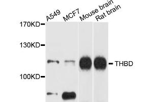 Western blot analysis of extracts of various cell lines, using THBD antibody (ABIN5972294) at 1/1000 dilution. (Thrombomodulin antibody)