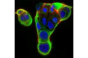 Immunofluorescence (IF) image for anti-X-Ray Repair Complementing Defective Repair in Chinese Hamster Cells 6 (XRCC6) (AA 6-214) antibody (ABIN5542547)