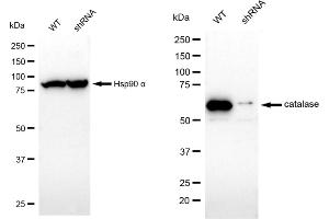 Western blotting analysis using catalase antibody (ABIN7797921). (Recombinant Catalase antibody)