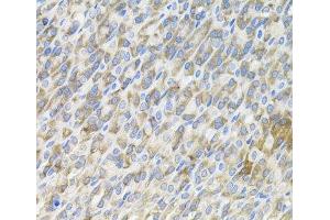 Immunohistochemistry of paraffin-embedded Mouse stomach using MBL2 Polyclonal Antibody
