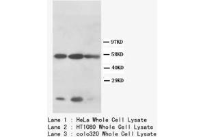Image no. 2 for anti-Keratin 8 (KRT8) (N-Term) antibody (ABIN1495179) (KRT8 antibody  (N-Term))