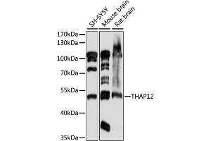 Western blot analysis of extracts of various cell lines, using TH antibody (ABIN7269714) at 1:1000 dilution. (PRKRIR antibody  (AA 1-300))