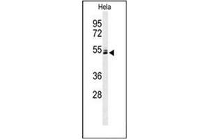 Western blot analysis of K2C78 Antibody (Center) in Hela cell line lysates (35ug/lane).