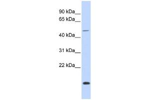 WB Suggested Anti-FOXN3 Antibody Titration:  0. (FOXN3 antibody  (Middle Region))