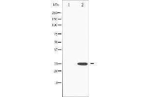 Western blot analysis of RhoA phosphorylation expression in HeLa whole cell lysates,The lane on the left is treated with the antigen-specific peptide. (RHOA antibody  (pSer188))