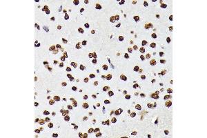 Immunohistochemistry of paraffin-embedded rat brain using Phospho-STA-Y694 antibody (ABIN6135328, ABIN6136272, ABIN6136273 and ABIN7101887) at dilution of 1:100 (40x lens). (STAT5A antibody  (pTyr694))