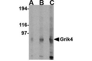 Western Blotting (WB) image for anti-Glutamate Receptor, Ionotropic, Kainate 4 (GRIK4) (C-Term) antibody (ABIN1030422)