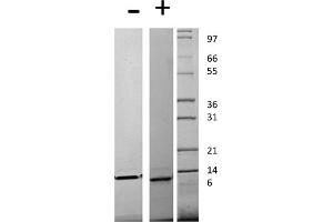 SDS-PAGE of Human Monocyte Chemotactic Protein-4 (CCL13) Recombinant Protein SDS-PAGE of Human Monocyte Chemotactic Protein-4 (CCL13) Recombinant Protein. (CCL13 Protein)