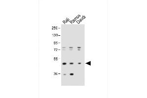All lanes : Anti-IGHE Antibody (Center) at 1:1000 dilution Lane 1: Raji whole cell lysate Lane 2: Ramos whole cell lysate Lane 3:Daudi whole cell lysate Lysates/proteins at 20 μg per lane. (IgE antibody  (AA 246-275))