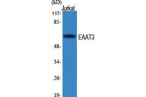 Western Blot (WB) analysis of specific cells using EAAT3 Polyclonal Antibody.