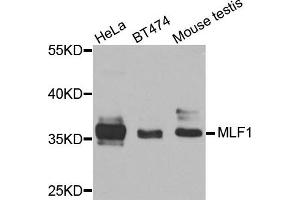 Western blot analysis of extracts of various cells, using MLF1 antibody. (MLF1 antibody)