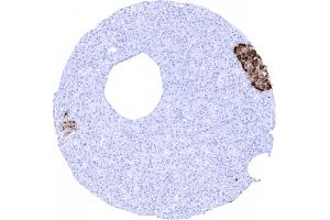 Immunohistochemistry (IHC) image for anti-Chromogranin A (CHGA) antibody (ABIN7477423)