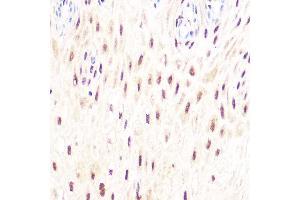 Immunohistochemistry of paraffin-embedded human esophageal using DP1/TFDP1 Rabbit mAb (ABIN7270891) at dilution of 1:100 (40x lens). (DP1 antibody)