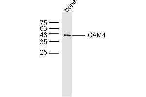 Mouse bone lysates probed with ICAM4 Polyclonal Antibody, unconjugated  at 1:300 overnight at 4°C followed by a conjugated secondary antibody at 1:10000 for 60 minutes at 37°C.