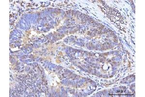 IHC analysis of RANBP2 using anti-RANBP2 antibody (ABIN7602650). (RANBP2 antibody  (AA 906-2744))