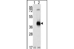 Western blot analysis of CK1 (arrow) using rabbit polyclonal CK1 Antibody (C-term) (ABIN391310 and ABIN2841344). (CAMK1 antibody  (C-Term))