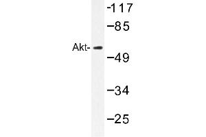 Image no. 1 for anti-V-Akt Murine Thymoma Viral Oncogene Homolog 1 (AKT1) antibody (ABIN272119) (AKT1 antibody)
