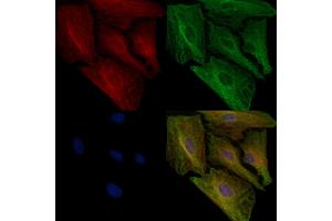 ABIN6257958 and ABIN6274924 staining  cells by IF/ICC.