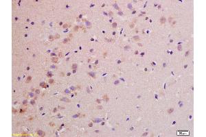 Formalin-fixed and paraffin embedded rat brain labeled with Rabbit Anti NDUFS1(75kD) Polyclonal Antibody, Unconjugated (ABIN750703) at 1:200 followed by conjugation to the secondary antibody and DAB staining