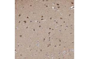 Immunohistochemical staining of human cerebral cortex with PLCH1 polyclonal antibody  shows moderate cytoplasmic positivity in neuronal cells.