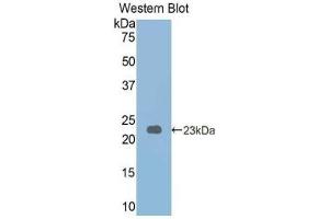 WB of Protein Standard: different control antibodies against Highly purified E.