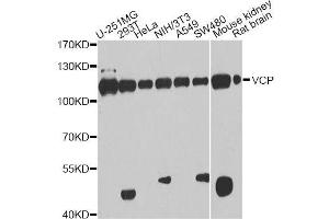 Western blot analysis of extracts of various cell lines, using VCP antibody. (VCP antibody  (AA 647-806))