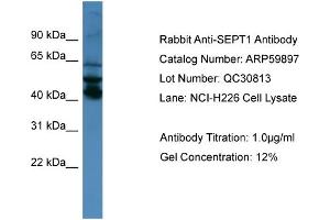WB Suggested Anti-SEPT1  Antibody Titration: 0. (Septin 1 antibody  (N-Term))