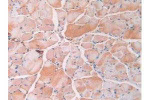 IHC-P analysis of Mouse Skeletal Muscle Tissue, with DAB staining. (Resistin antibody  (AA 21-114))