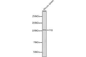 Western blot analysis of extracts of Mouse spleen, using FYB antibody (ABIN7267283) at 1:1000 dilution. (FYB antibody  (AA 678-829))