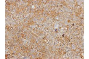 IHC-P Image Immunohistochemical analysis of paraffin-embedded SW480 xenograft, using CHI3L2, antibody at 1:500 dilution.