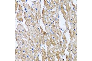 Immunohistochemistry of paraffin-embedded mouse heart using ATP5B antibody. (ATP5B antibody  (AA 230-529))