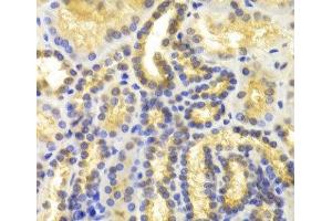 Immunohistochemistry of paraffin-embedded Human kidney using EIF5A Polyclonal Antibody at dilution of 1:100 (40x lens).