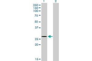 Western Blot analysis of NDUFS3 expression in transfected 293T cell line by NDUFS3 monoclonal antibody (M02), clone 1D6. (NDUFS3 antibody  (AA 1-264))