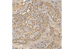 IHC analysis of SNRPD2 using anti-SNRPD2 antibody (ABIN7598963).