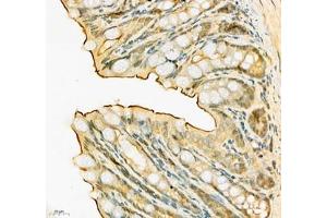 Immunohistochemistry of paraffin embedded mouse colon using SLC6A19 (ABIN7075682) at dilution of 1:900 (400x lens)