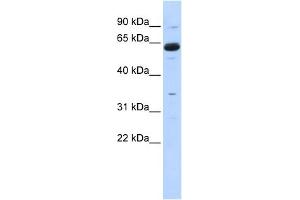 WB Suggested Anti-CPNE1 Antibody Titration:  0. (CPNE1 antibody  (Middle Region))