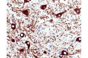 Dynamin (clone 41) staining on rat brain. (Dynamin 1 antibody  (AA 698-851))