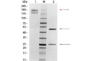 SDS-PAGE of Mouse anti-Mesothelin Monoclonal Antibody. (Mesothelin antibody)