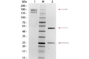 SDS-PAGE of Mouse anti-Mesothelin Monoclonal Antibody.